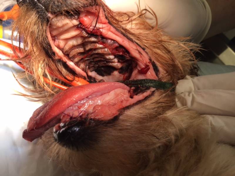 restauration gueule saine après exerese dents infectees