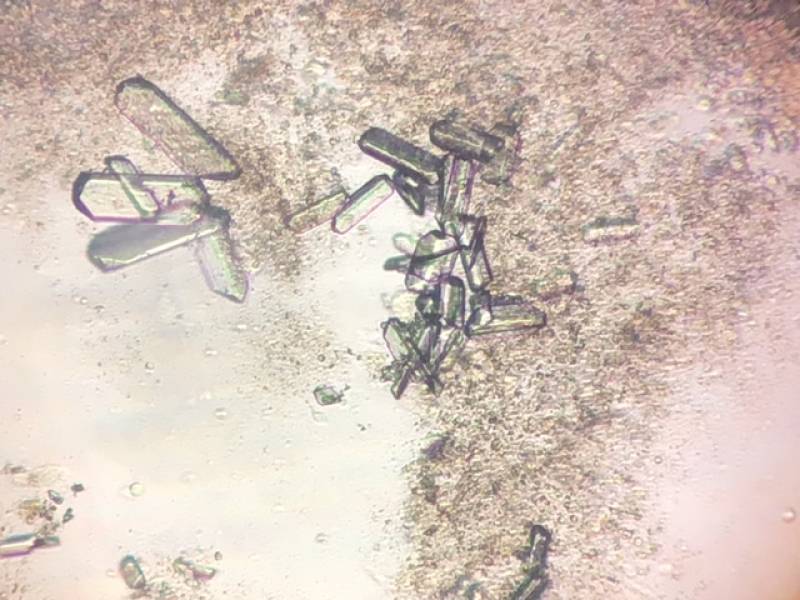 calculs de struvites sur lame microscopique