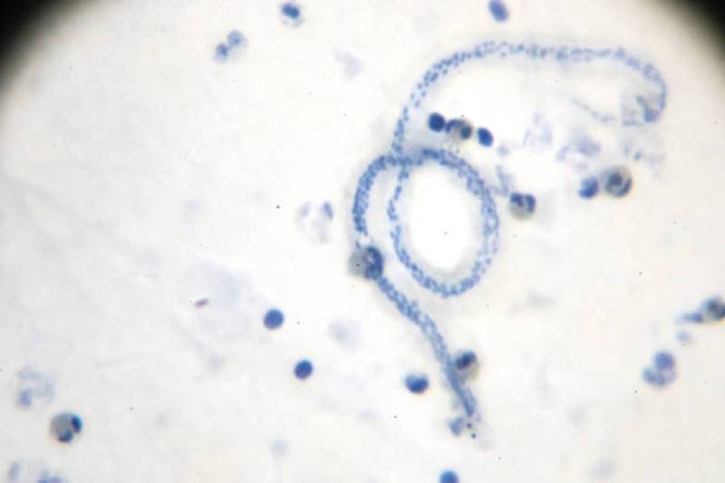 leptospires saint valery en caux