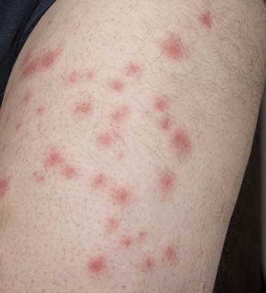 problème puces chien chat proche saint valery en caux