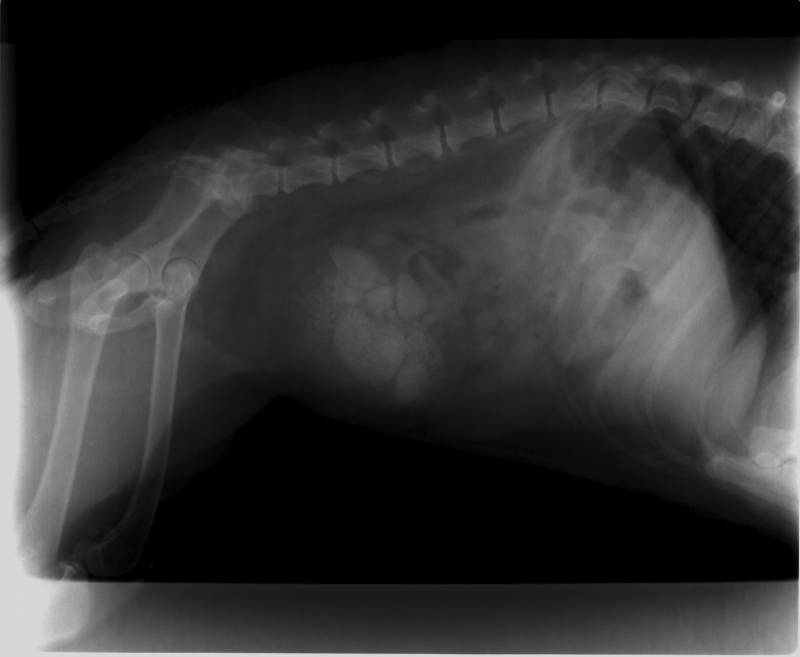 calculs urinaires il etait grand temps d'operer